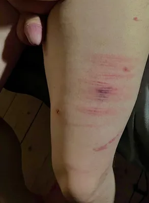 Piggy stripes