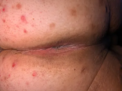 Sissy hole in training. Plug doing the work!