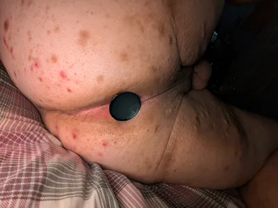 Make this Sissy's dream of Permenant Exposure True