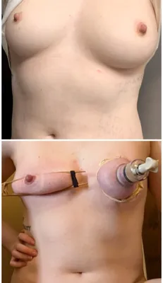 Quick before & after
