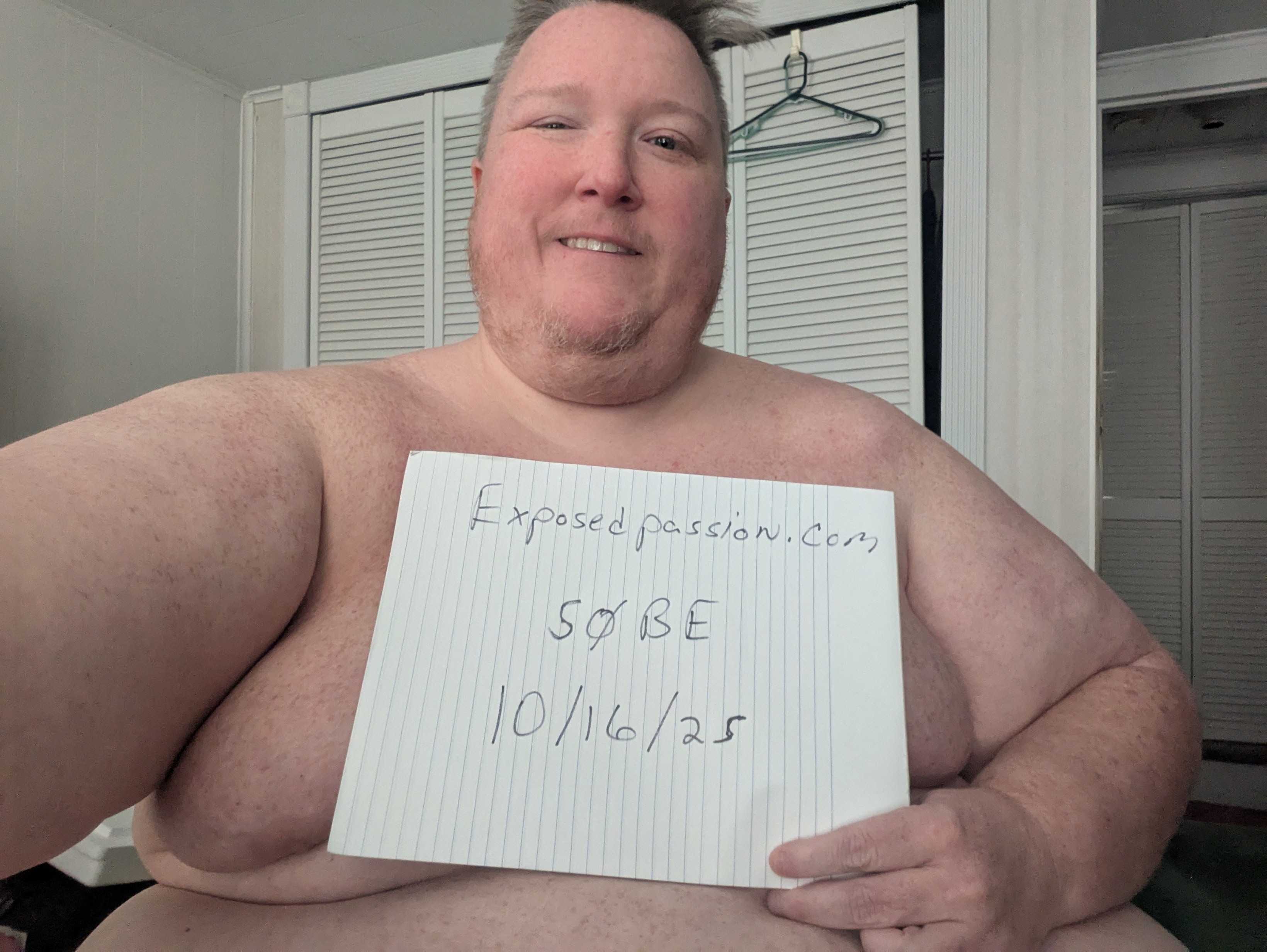 50BE-Fatty Exposed
