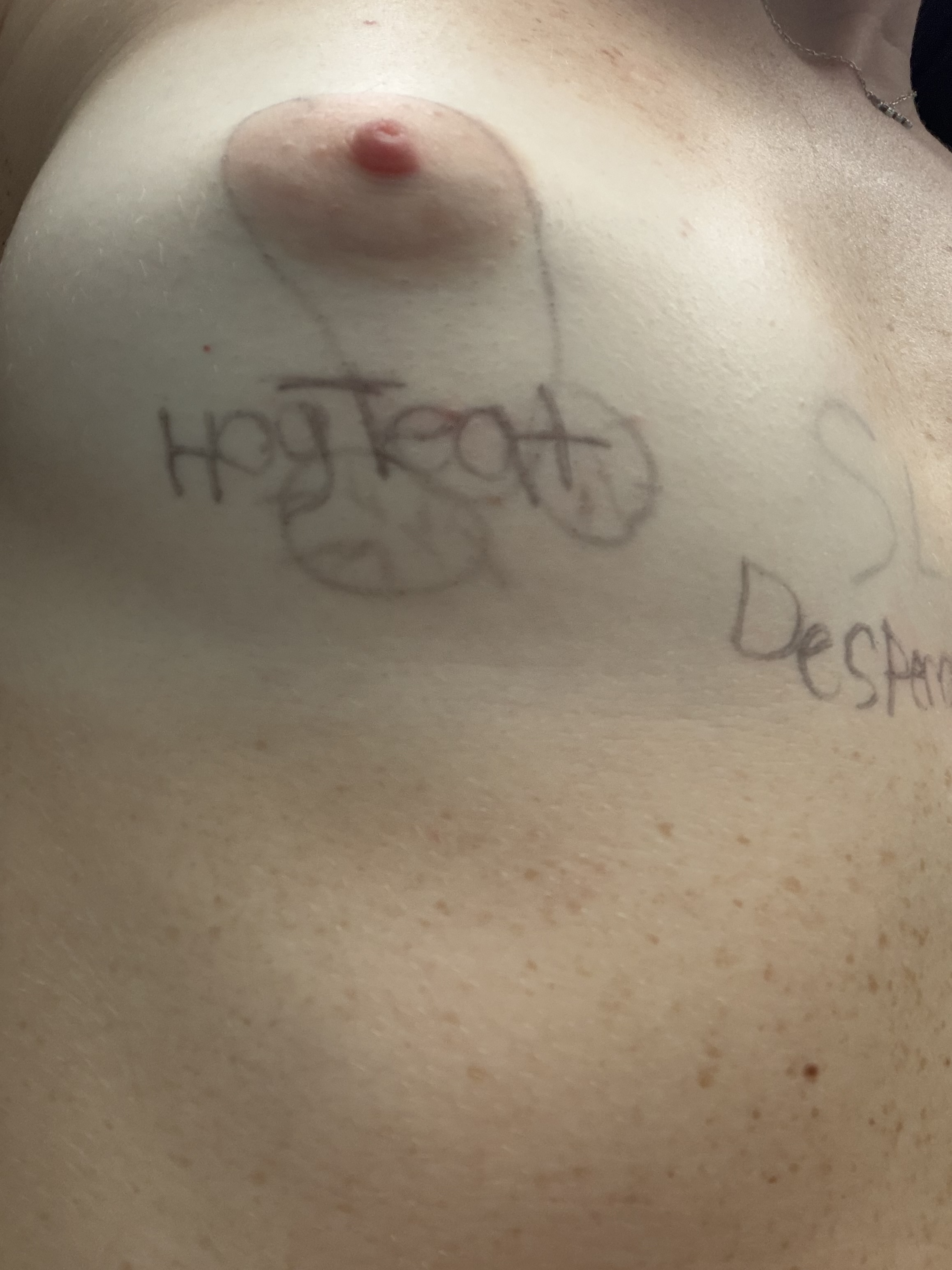Hog Teat