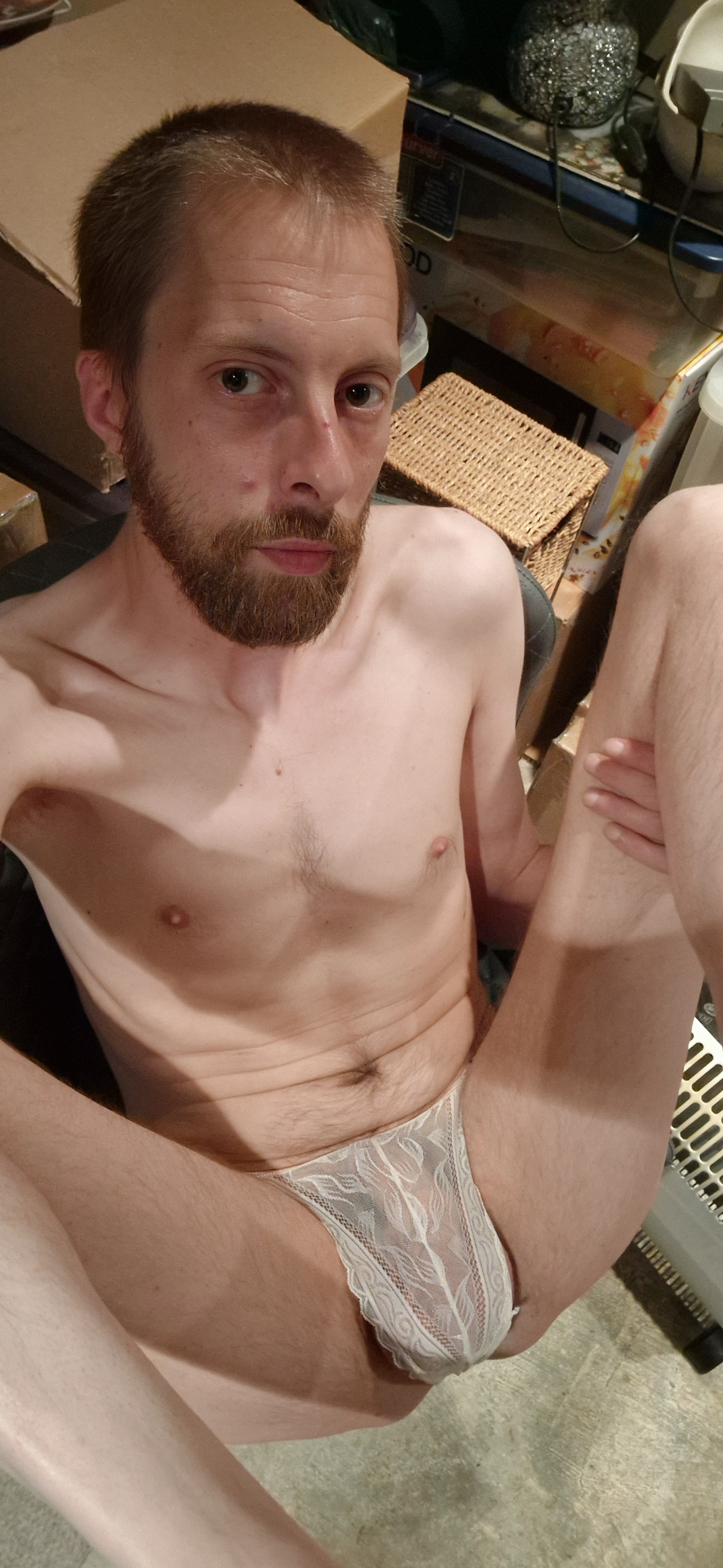 Dumb Fag seeks Exposure